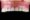 Maxillofacial Prosthesis